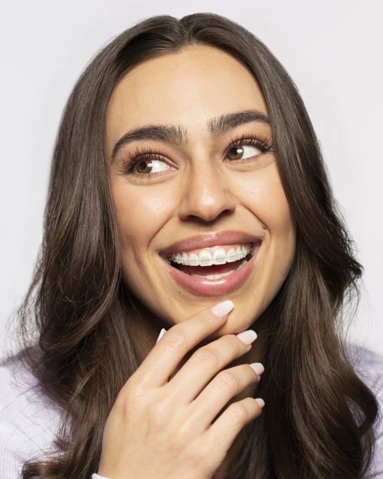 Ceramic Braces