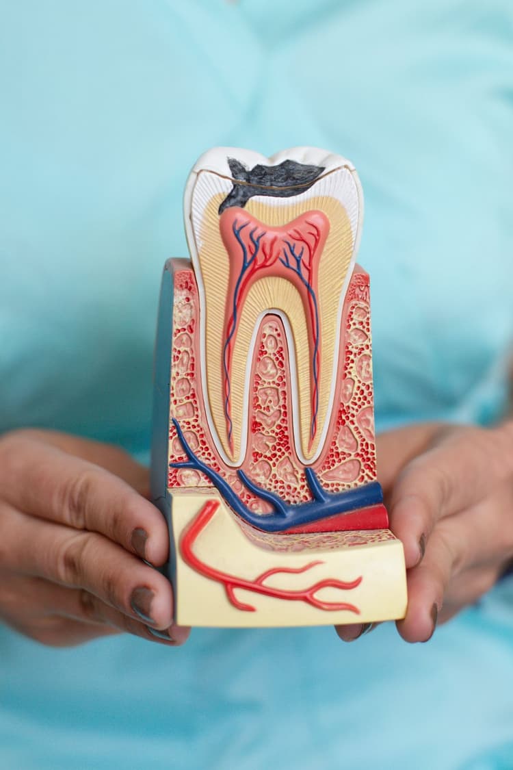 Root Canal Treatment